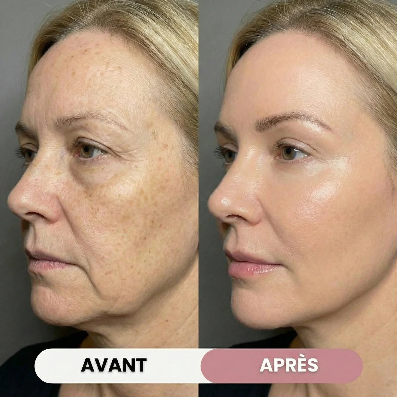 Crème Gelée au Collagène
